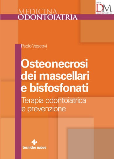 Immagine copertina Osteonecrosi dei mascellari e bisfosfonati