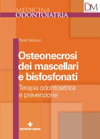 Immagine copertina Osteonecrosi dei mascellari e bisfosfonati