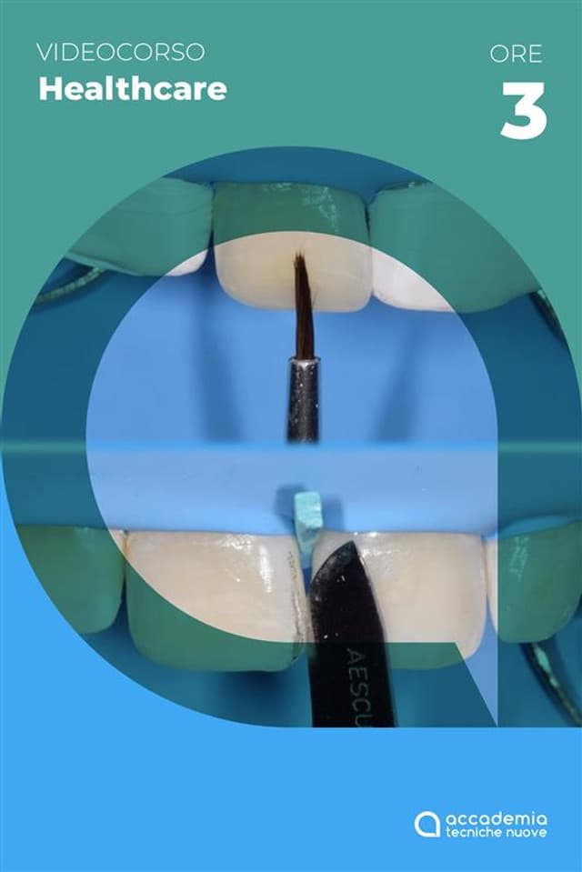 Le determinanti di forma e colore per il successo nel restauro estetico anteriore in composito - 2023