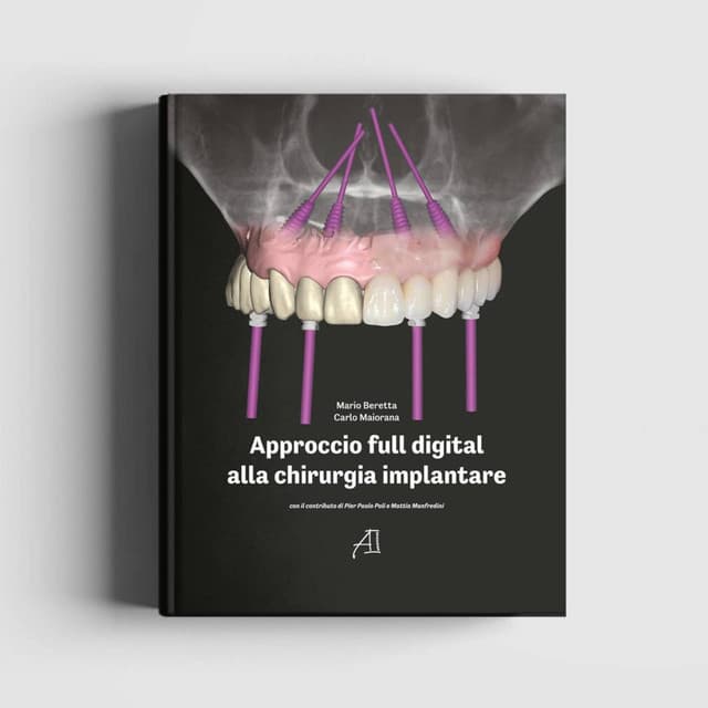 Approccio full digital alla chirurgia implantare