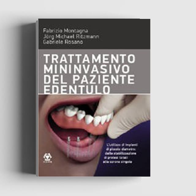 Trattamento mininvasivo del paziente edentulo
