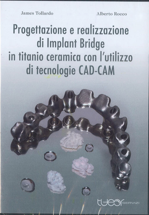 Tecniche Nuove - Progettazione e realizzazione di Implant Bridge in titanio ceramica con l'utlizzo di tecnologie CAD-CAM