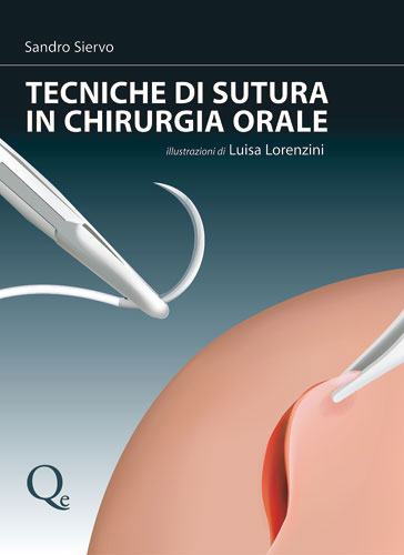 Tecniche Nuove - Tecniche di sutura in chirurgia orale