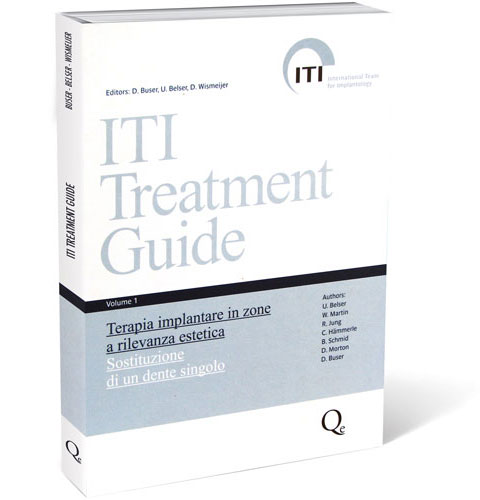 Tecniche Nuove - ITI Treatment Guide. Volume 1