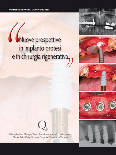 Tecniche Nuove - Nuove prospettive in implanto-protesi e in chirurgia rigenerativa