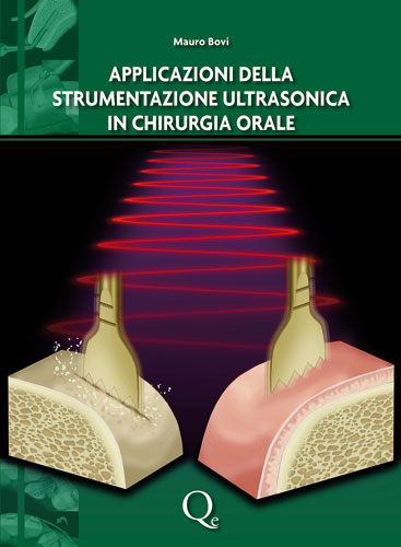 Tecniche Nuove - La strumentazione ultrasonica in chirurgia orale