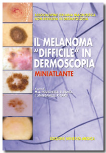 Tecniche Nuove - Il Melanoma "difficile" in Dermoscopia